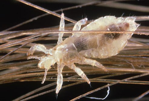 A Parent S Nightmare Head Lice Steemit