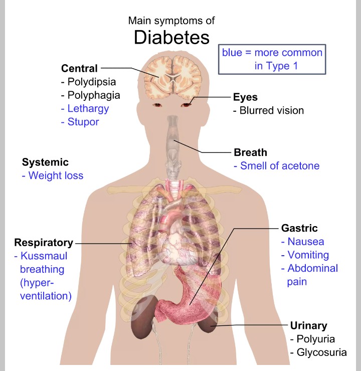 diabete 1.jpg