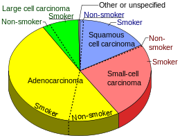 260px-Pie_chart_of_lung_cancers.svg.png