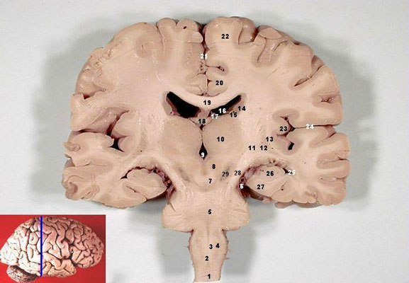 Human_brain_frontal_(coronal)_section_description_2-.jpg