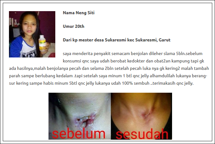 Image result for testimoni infeksi luka qnc