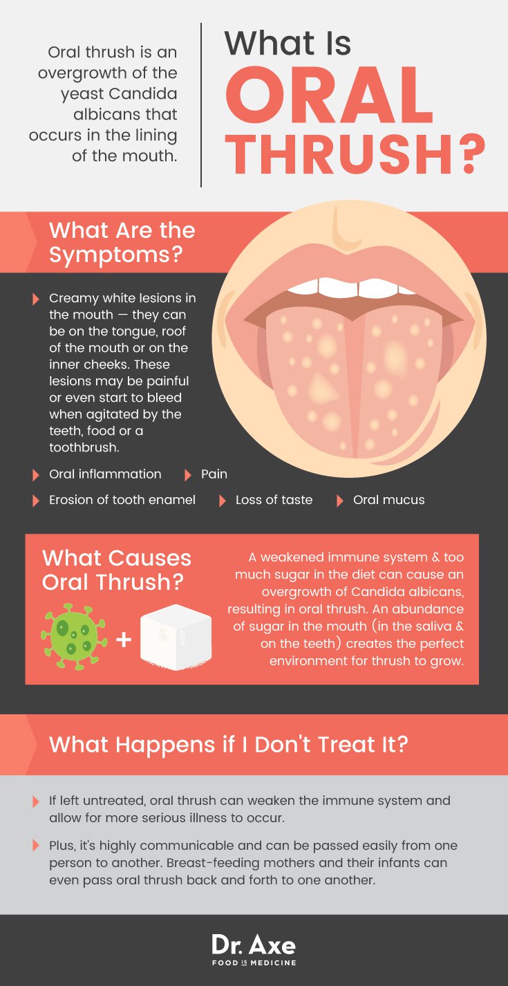 medication for oral thrush in adults