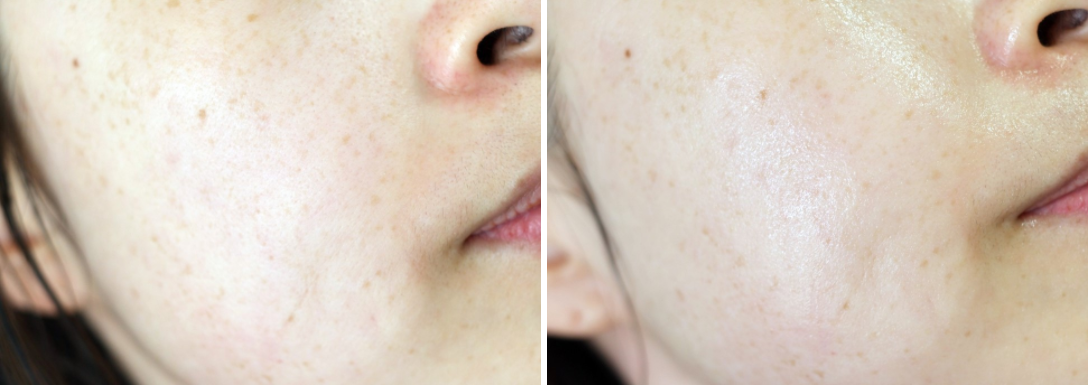 Screenshot 2017-07-12 at 23.40.00.png