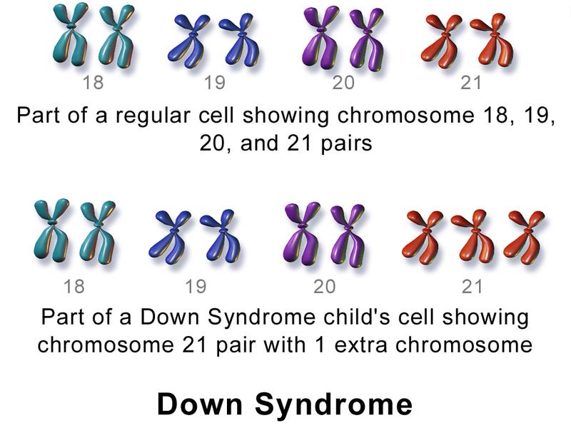 down syndrome genes.jpg