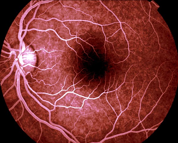 eye ball.jpg