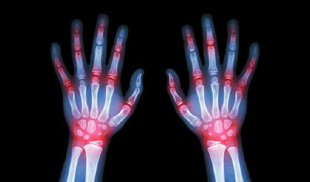 timg (2)_meitu_3.jpg