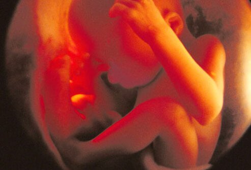 fetal_ultrasound_28_weeks_s10a.jpg