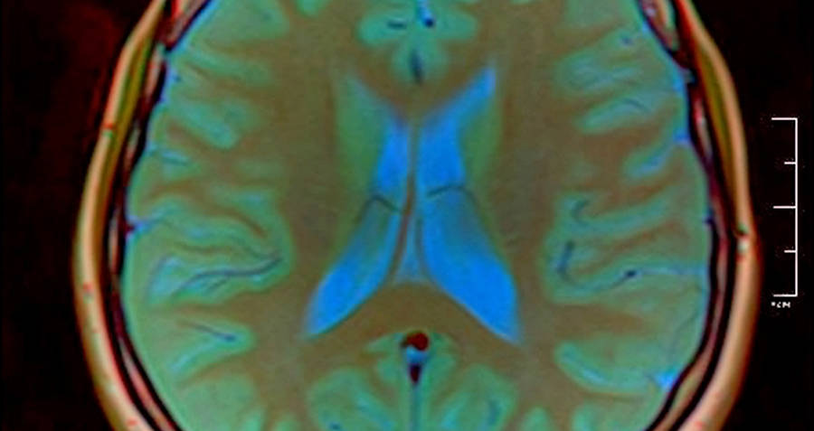 brain-scan.jpg
