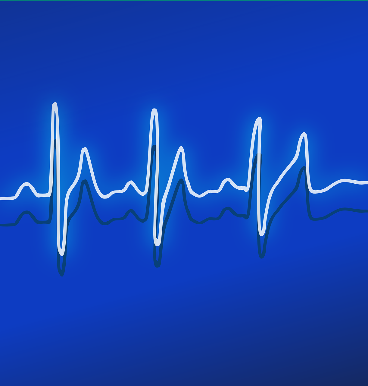 ekg-158177_1280.png