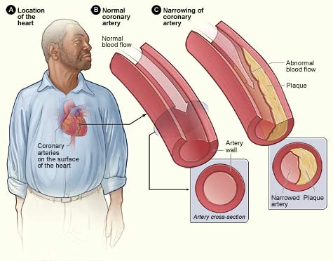 weakness of the blood vessels.jpg