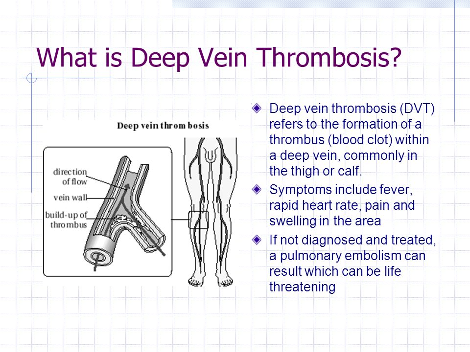 thrombosis.jpg