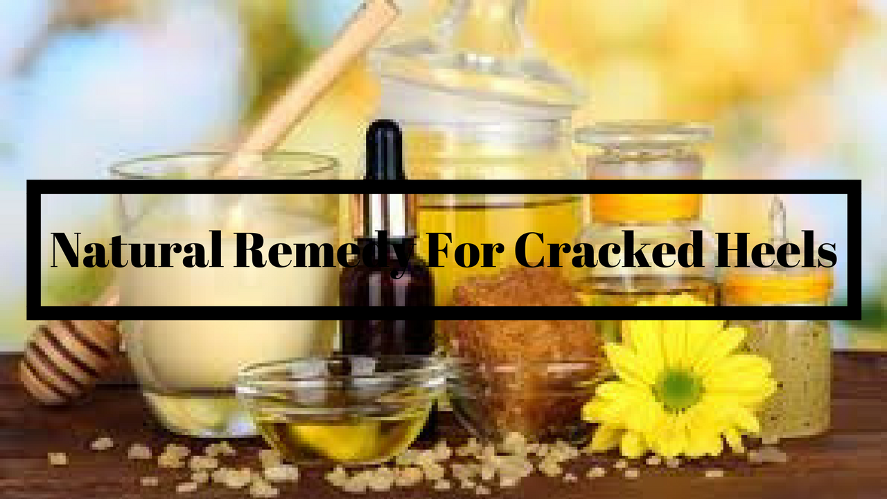 Natural Remedy For Cracked Heels.png