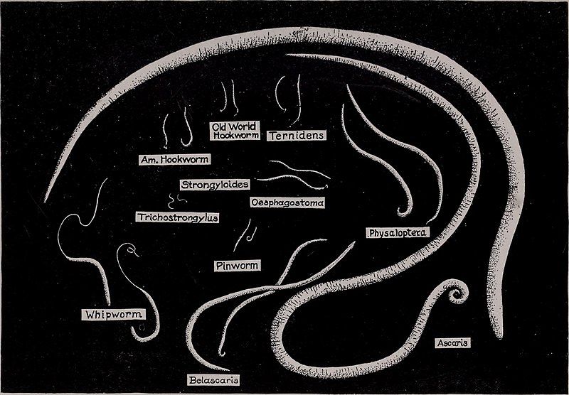 Animal_parasites_and_human_disease_(1918)_(18194916912).jpg