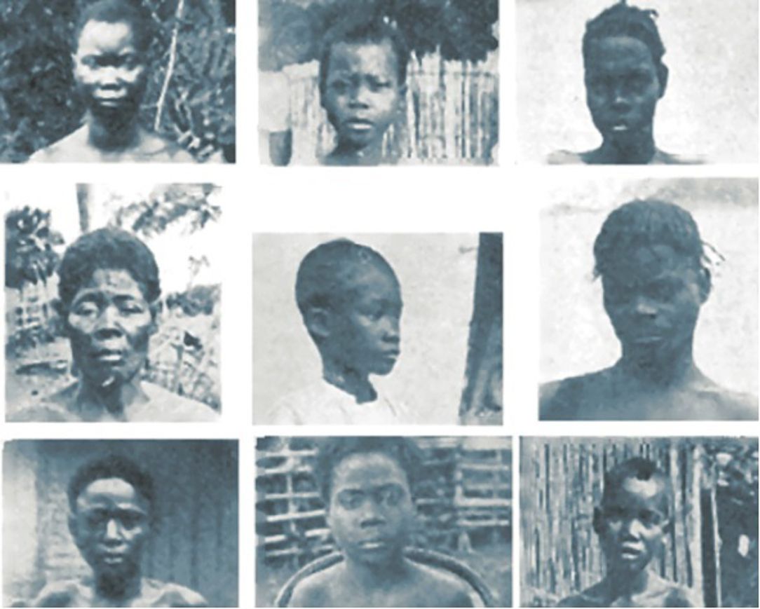 faces of maimed in the congo.jpg