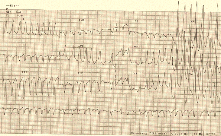 electro caso 1.gif