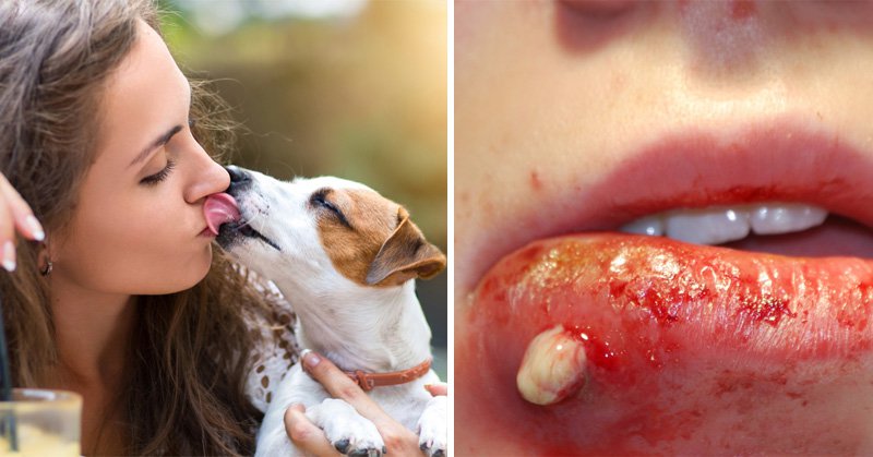 can you get worms from a dog licking you