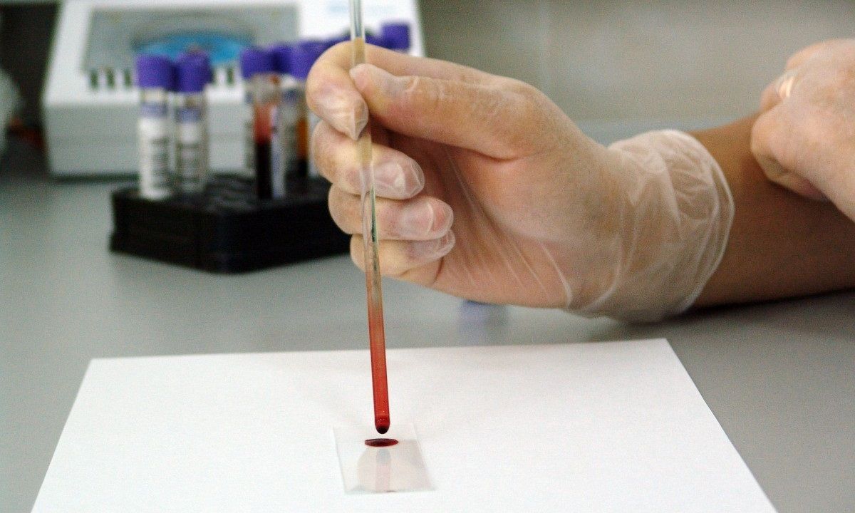 blood_sample_lab_laboratory_medical_drop_glass_research-.jpg