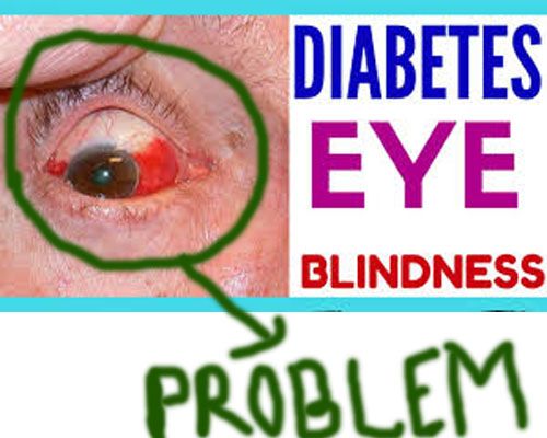 Diabetes Eye Problems - Help Health