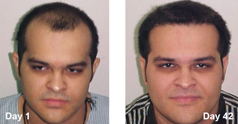 male1-before-after.png