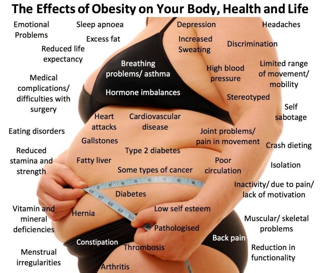 obesity.jpg