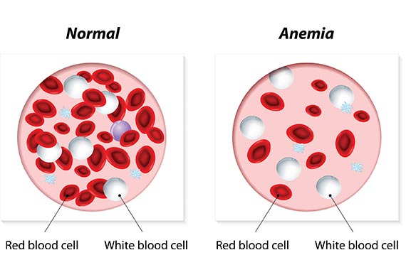 1-anemia-dog-529275877.jpg