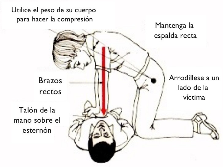 rcp-basico-y-avanzado-28-728.jpg