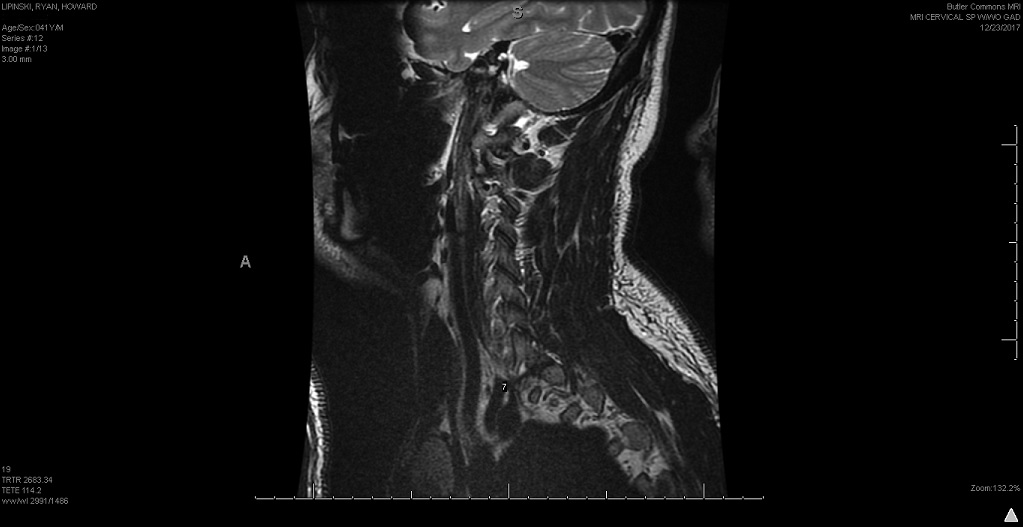 cervical 1.jpg