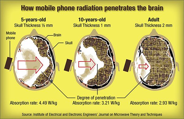 radiation-penetrates-brain 100 6 4.jpg