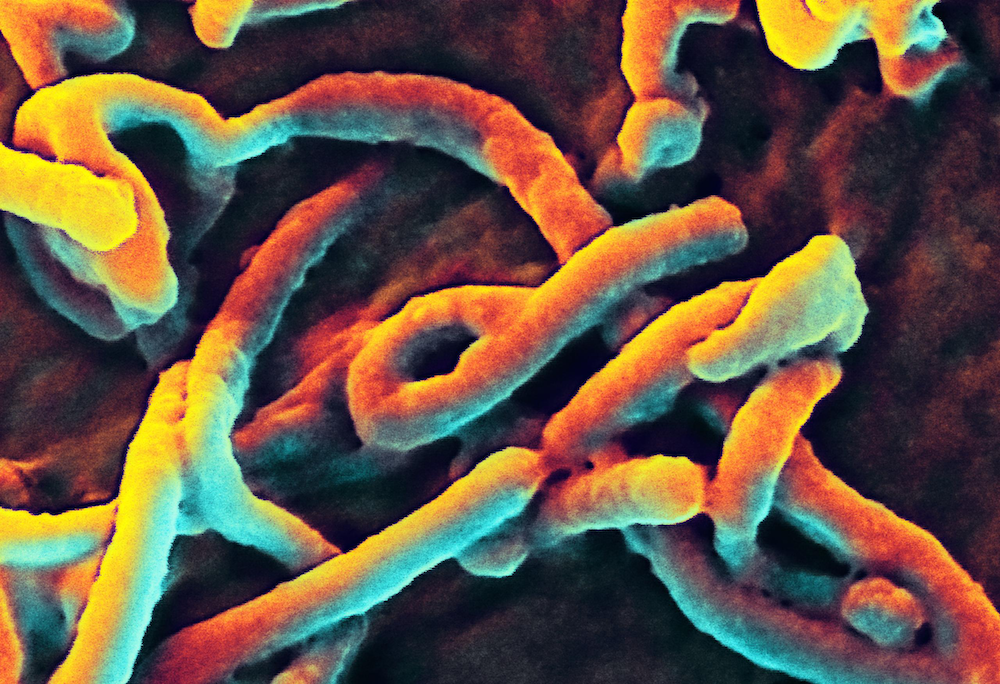 ebola-filaments-141005.png
