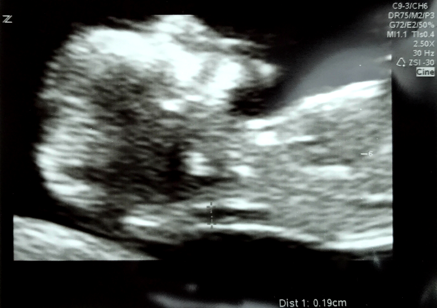 Ultrasound Image - Large.jpg