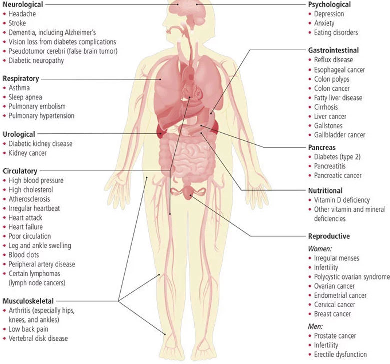 Causes Of Weight Gain Not Related To Nutrition Steemit