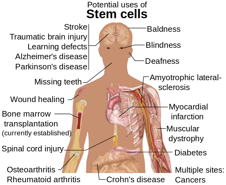 Stem_cell_treatments.png