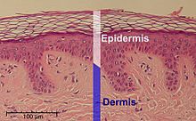 220px-Epidermis-delimited.jpg