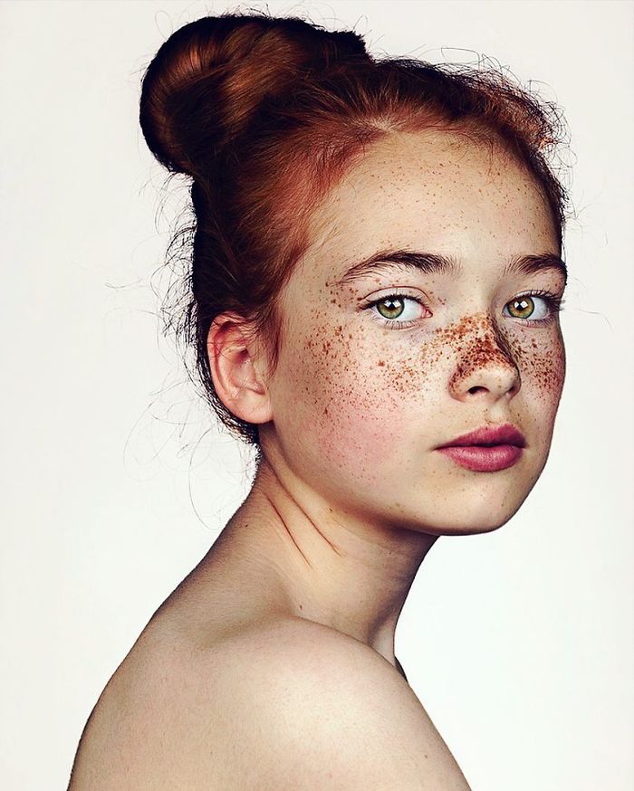 The-beauty-of-the-freckles-by-the-photographer-Brock-Elbank-5a829df8e7230__700.jpg