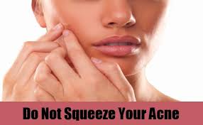 acne squeeze.jpg