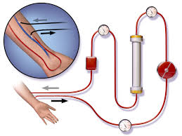 Hemodialysis & Peritoneal Dialysis.jpg