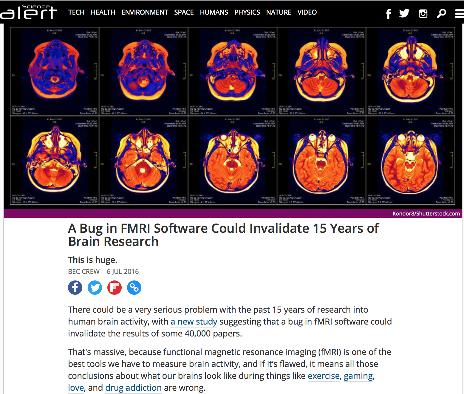 A bug in FMRI sotware could invalidate 15years of brainresearch.png