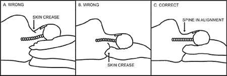 Wanna Avoid Back Neck Pain Learn The Correct Sleeping Positions