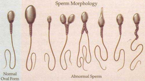 sperm (1).jpg