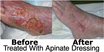 apinatebeforeafter1.jpg