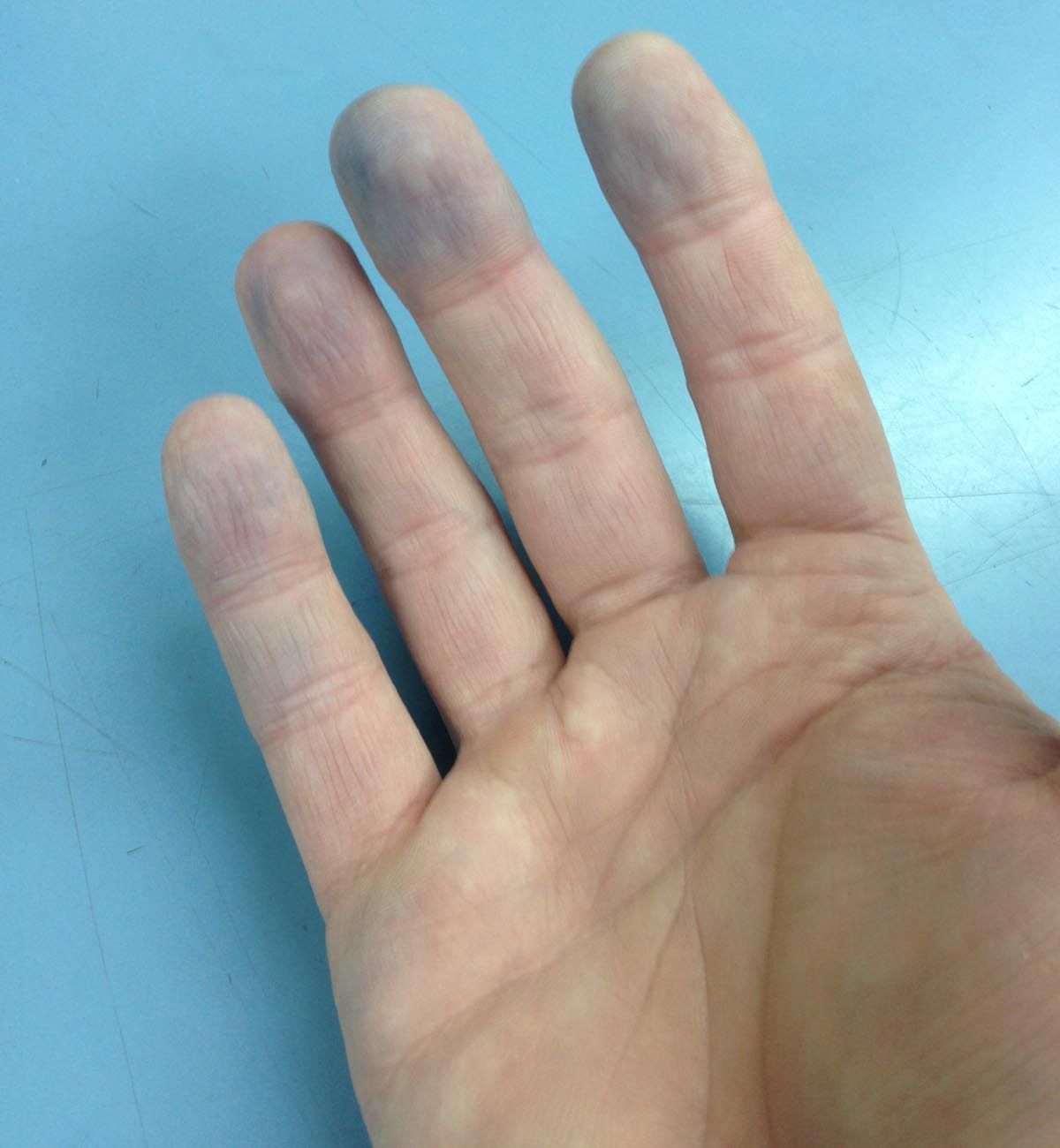 Blue_finger_tips_2.jpg