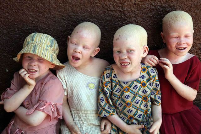albinos-tanzania-10-1 (1).jpg