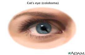 cat-eye.jpg