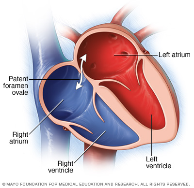 foramen ovale.png