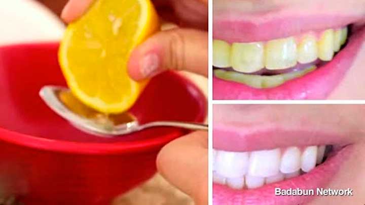 dientes-limon.jpg