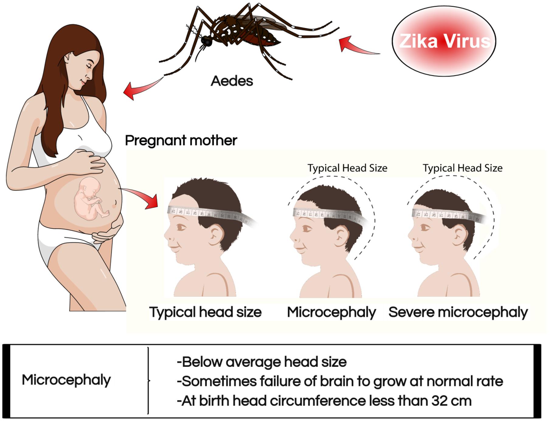 zika4.jpg