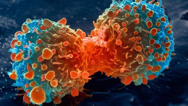 lung-cancer-cell-dividing-article.__v600248237.jpg
