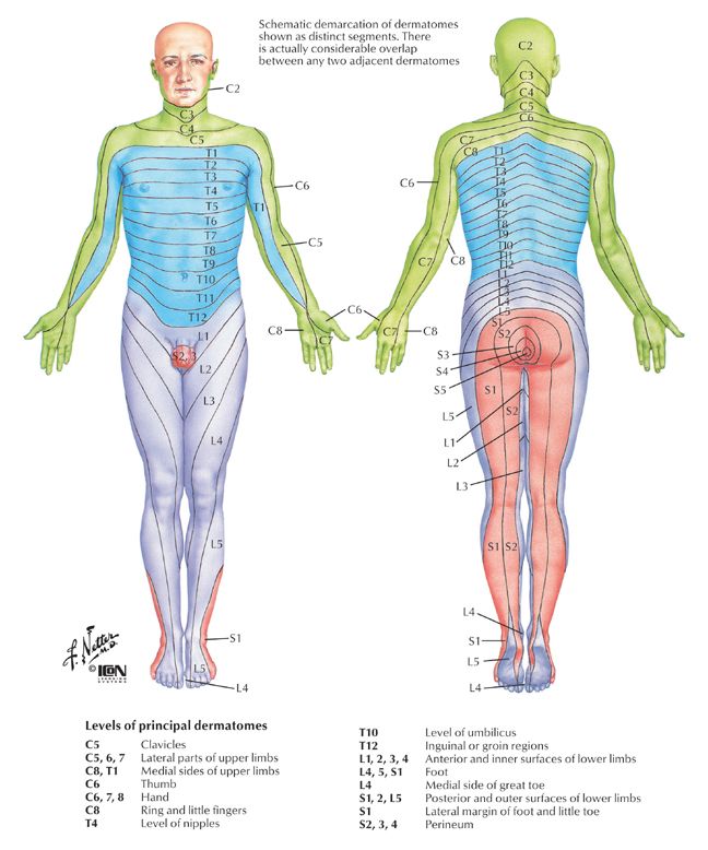 06-4 Radiculopathy.jpg