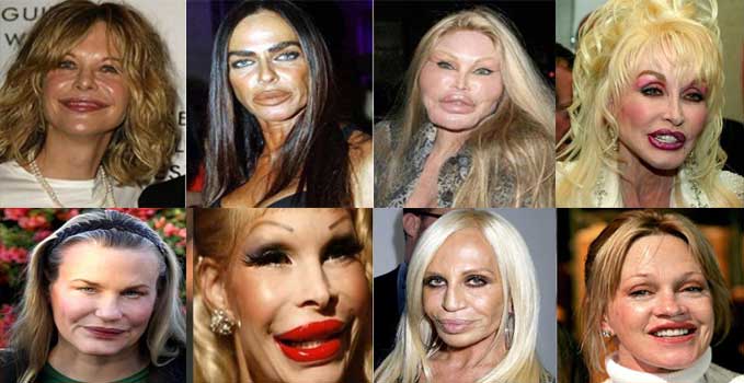 Bad Plastic Surgery.jpg