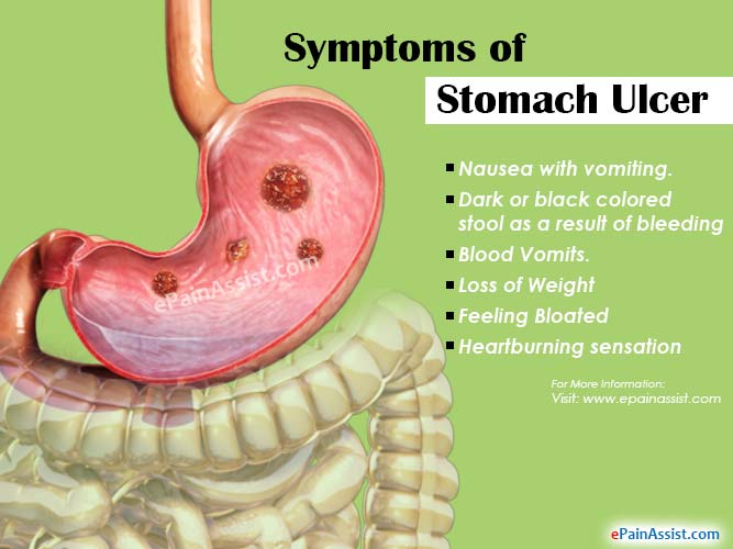 symptoms-stomach-ulcer.jpg